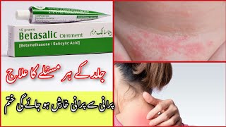 Betasalic ointment review  Betasalic cream ke fayde  How to use betasalic ointment  خارش کا علاج [upl. by Auberta41]