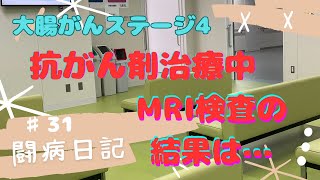 ♯31がんが進行したの？MRI検査結果【大腸がんステージ4】 [upl. by Allemac]