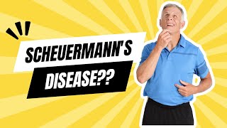 What is Scheuermanns Disease [upl. by Blanch297]