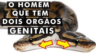 6 condições médicas mais BIZARRAS [upl. by Hyatt593]