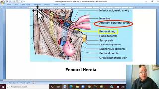 Musculoskeletal Module  Anatomy of Lower Limb in Arabic 40  Femoral canal and hernia Wahdan [upl. by Stubbs351]