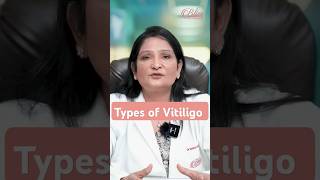 Types of Vitiligo  Vitiligo skin disease  Vitiligo Treatment in Ludhiana [upl. by Aracot]