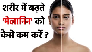 शरीर में मेलानिन की मात्रा कैसे कम करें Skin Glow का जबरदस्त इलाज Watch Video  Boldsky [upl. by Eceela]