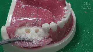 Dental Implant Hands On training video [upl. by Aiz]