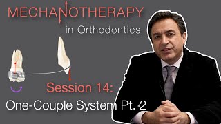 Mechanotherapy in Orthodontics OneCouple System Pt 2 [upl. by Navap]