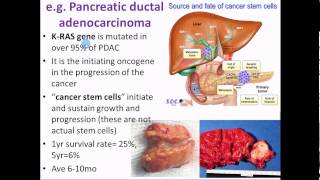 Pathophysiology 18 Etiology and Pathogenesis of Cancer [upl. by Haidabej742]