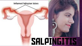 SALPINGITIS in hindi salpingitis salpingitiscauses inflammationofoviduct [upl. by Jacobs]