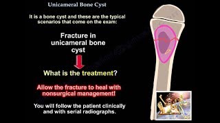 Cysts of the Jaws Part 1 [upl. by Piggy904]