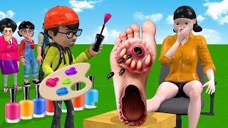 Scary Teacher 3D vs Squid Game Feet Treatment or Error 5 Time Challenge [upl. by Ioved]