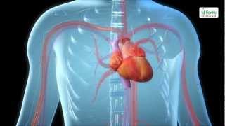 Angioplasty Procedure Animation Video [upl. by Hudnut]