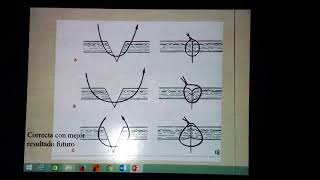 Clase1Tipos de Suturas materiales de sutura y Técnica quirúrgicaDrChapaParte4 [upl. by Nikoletta]