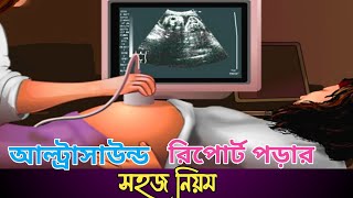 আল্ট্রাসাউন্ড রিপোর্ট পড়ার সহজ নিয়ম  আল্ট্রাসনোগ্রাফি রিপোর্ট বুঝার উপায়  Ultrasound report read [upl. by Alexandre]