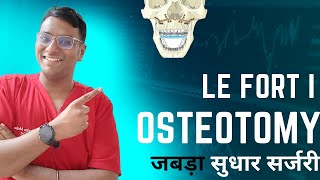 Dr Rudra Mohan  जबड़े के सुधार के लिए सर्जरी  Orthognathic Surgery  Le Fort I Osteotomy [upl. by Airolg]