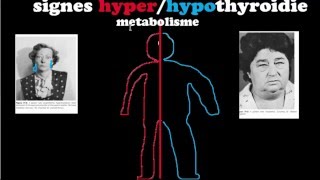 🔴 Dr Astuce  HYPERHYPOTHYROIDIES EXPLIQUÉES CLAIREMENT [upl. by Eanaj]