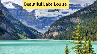 Experience Beautiful Lake Louise with Us  Rupi’s Lifelogs  Banff Vlog  4 [upl. by Gitlow969]