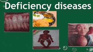 Deficiency diseases components of Food  deficiency diseases class 6 [upl. by Eada]