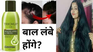 Trichup hair oil से बाल लंबे होंगे  trichup hair oil results  trichup hair oil reviews  trichup [upl. by Mychael666]