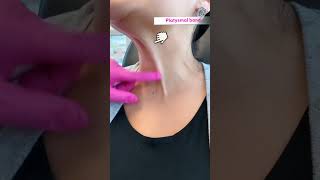 Botox for neck lines 💉Check this out ✨💖 [upl. by Chev]