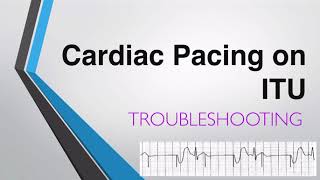 Troubleshooting Transvenous Pacing  Cardiac Pacing on ITU [upl. by Nywled]