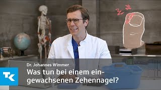 Was tun bei einem eingewachsenen Zehennagel  Dr Johannes Wimmer [upl. by Jonny]