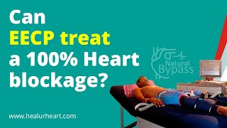 Can EECP treat a 100 Heart blockage [upl. by Nnylrahc]