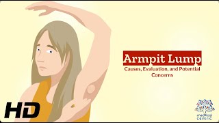 Unveiling the Mystery Understanding Armpit Lumps [upl. by Odlopoel]