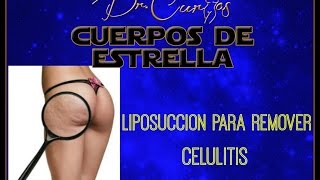 Liposucción y la Celulitis  Dr Cortes  Cirujano Plástico Houston [upl. by Faythe]