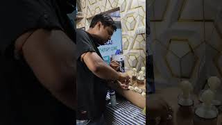 cupping therapy  back pain kamar dard backpain Dr Anmol k Singh 85409687641 [upl. by Lilian]