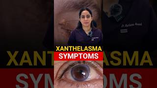 Most Common Symptoms Xanthelasma [upl. by Yllut]