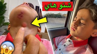 شي غربي طلع في رقبت يمان 😨 [upl. by Calore836]