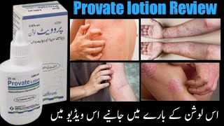 Provate lotion Uses and Side Effects in Urdu Hindi Provate lotion benefits Allergy Treatment [upl. by Animar]