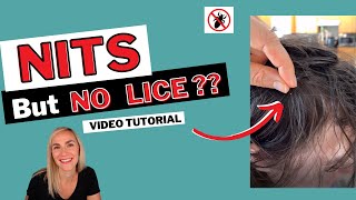 Nits But No Lice Tutorial [upl. by Kaya]