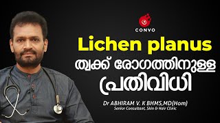 Lichen Planus  Skin disorder amp Treatment  Malayalam  Skin Disease Dr ABHIRAM V K  Convo Health [upl. by Ginevra]