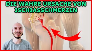 Die WAHRE Ursache von ISCHIASSCHMERZEN IschiasSyndrom  Wenn das Fundament wackelt [upl. by Ayom451]