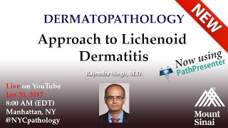 Dermatopathology Approach to Lichenoid Dermatitis  w Dr Singh [upl. by Rabjohn]