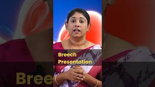 Breech presentation pregnancytips normaldelivery baby drsavitha udumalpet [upl. by Adniled811]