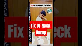 Fix Ur Neck Hump neckhump physiotherapy physiotherapycenter bhuvikatv [upl. by Jefferson]