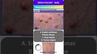 Cutaneous Signs and Diagnosis Quiz  Part 1 medicalmcqs dermatologyquiz [upl. by Fulviah]