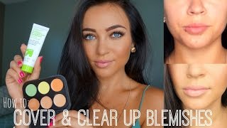 How to Cover amp Clear Up Blemishes [upl. by Stephania]