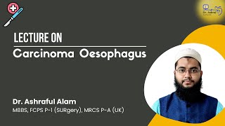 Carcinoma of Oesophagus Surgery Lecture [upl. by Victoir]