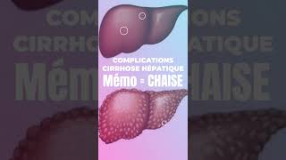 Mémo  Complications de la Cirrhose Hépatique [upl. by Otsuaf]