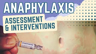 Anaphylaxis Assessment and Interventions Nursing [upl. by Zeculon784]