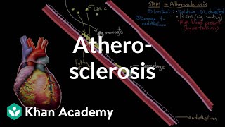 Atherosclerosis  Circulatory System and Disease  NCLEXRN  Khan Academy [upl. by Niltyak]