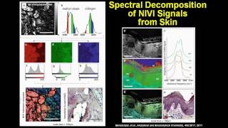 Coherence Imaging of Cancer with Novel Optical Sources  Stephen Boppart [upl. by Idnew]