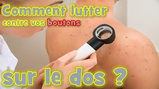 bouton dacné  Comment lutter naturellement contre vos boutons sur le dos [upl. by Aehtrod771]