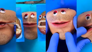 Fruit Surgery with Mr Kiwi Original Mr Kiwi Episodes Discount Dentist  TikTok  Fleeting Films [upl. by Ahsaetal716]