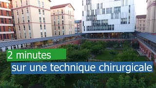 2 minutes  Tout savoir sur la Fistule ArtérioVeineuse FAV [upl. by Eelrebmyk623]