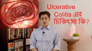 What is ulcerative colitis Ulcerative colotis কি [upl. by Land]