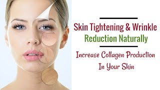 Collagen Food  Naturally Increase Collagen Production In Your Skin [upl. by Davidson]