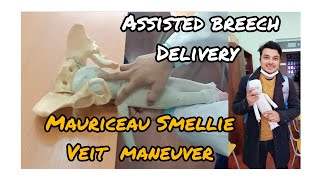 Mauriceau Smellie veit maneuverAssisted breech delivery  aquiqur rahman college mbbs mbbsabroad [upl. by Pelagias]